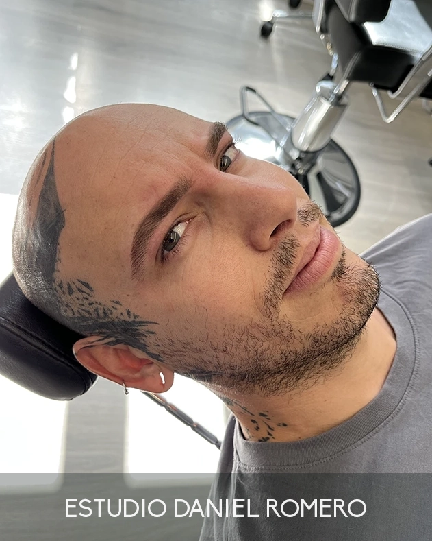 Micropigmentación de cejas en hombre con acabado natural y técnica Pixel
