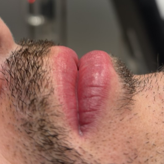 Micropigmentación de labios en hombre con resultado natural en Málaga