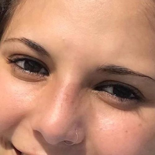 Antes de recuperación de cejas