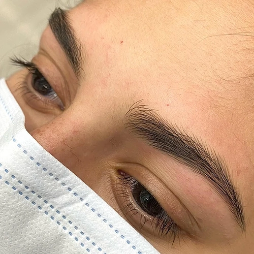 Despues de recuperación de cejas en Málaga